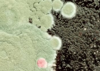 Aspergillosis Explained: Types, Symptoms, and Who's at Risk