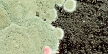 Aspergillosis Explained: Types, Symptoms, and Who's at Risk