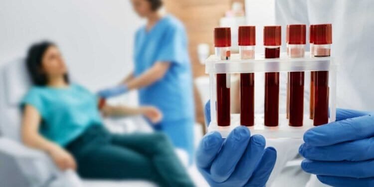 Aspergillosis: Navigating Diagnosis and Early Detection