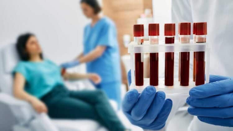Aspergillosis: Navigating Diagnosis and Early Detection