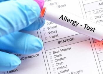 Mold Allergy Testing: What to Expect and When to See a Doctor