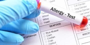 Mold Allergy Testing: What to Expect and When to See a Doctor