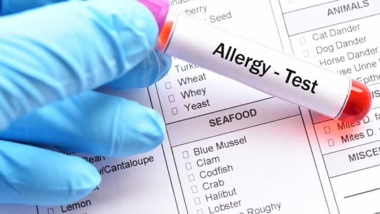 Mold Allergy Testing: What to Expect and When to See a Doctor