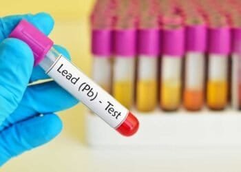 The Dangers of Lead Poisoning- Risks and Symptoms Explained