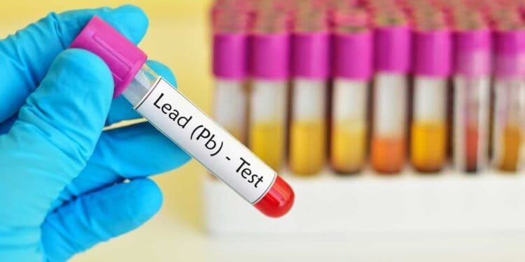 The Dangers of Lead Poisoning- Risks and Symptoms Explained