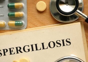 Unmasking the Link: Mold Exposure and Aspergillosis