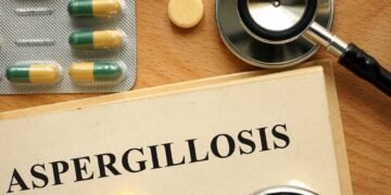 Unmasking the Link: Mold Exposure and Aspergillosis