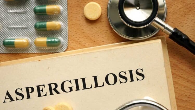 Unmasking the Link: Mold Exposure and Aspergillosis