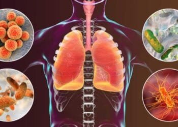 Could Mold Be the Culprit Behind Your Upper Respiratory Tract Infection Symptoms?