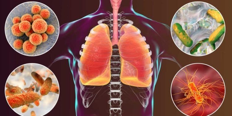Could Mold Be the Culprit Behind Your Upper Respiratory Tract Infection Symptoms?