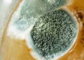 DIY Kits vs. Professional Analysis: Decoding Mold Test Results Explained