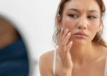 Expert Dermatological Advice on Mold Exposure and Skin Care: Tips from Dermatologists
