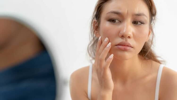 Expert Dermatological Advice on Mold Exposure and Skin Care: Tips from Dermatologists