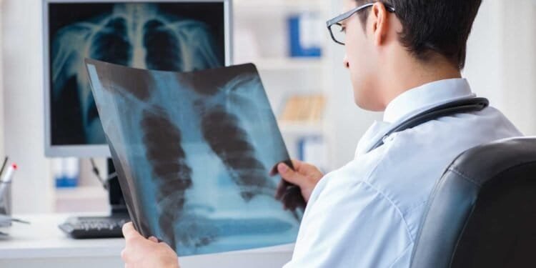 Long-Term Effects of Mold Exposure on Lung Health: What You Need to Know