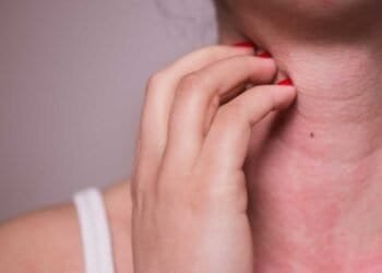 Mold Allergies: Understanding Symptoms, Diagnosis, and Management