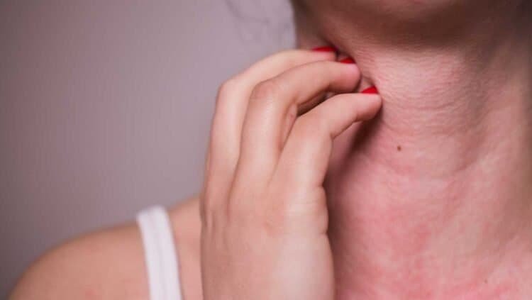 Mold Allergies: Understanding Symptoms, Diagnosis, and Management