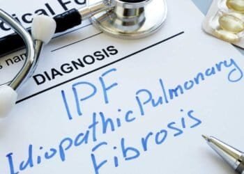 Pulmonary Fibrosis and Mold