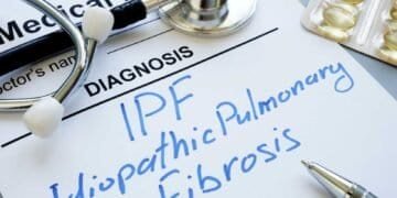 Pulmonary Fibrosis and Mold