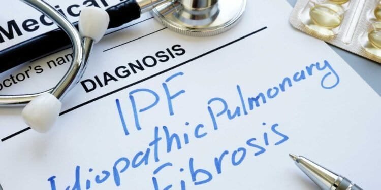 Pulmonary Fibrosis and Mold