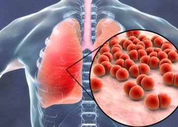 The Link Between Respiratory Infections and Mold in the Home: Exploring the Connection