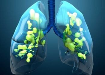 The Science of Mold: Respiratory Tract Invasion and Effects