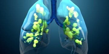 The Science of Mold: Respiratory Tract Invasion and Effects