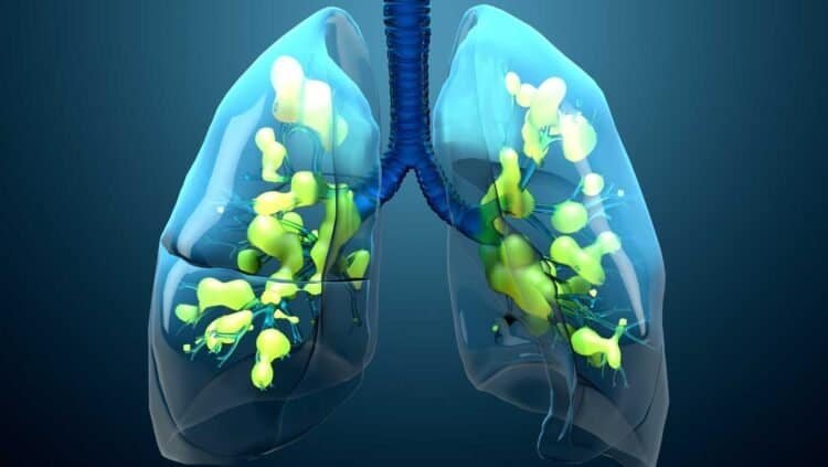 The Science of Mold: Respiratory Tract Invasion and Effects