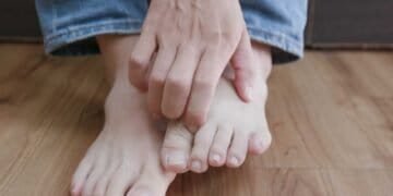 Could Mold be Causing or Aggravating Your Athlete's Foot Symptoms?