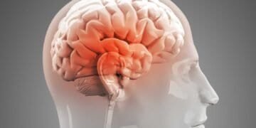 Could Mold be Causing or Aggravating Your Headaches?