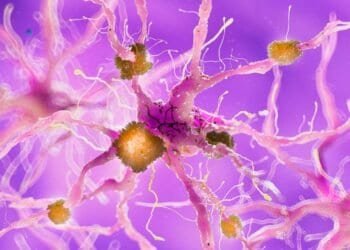 Identifying the Signs of Mold-Induced Neurological Symptoms