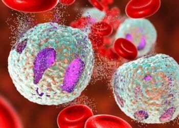 Mold Detox: Reducing Immune System Burden with These Tips