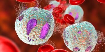 Mold Detox: Reducing Immune System Burden with These Tips