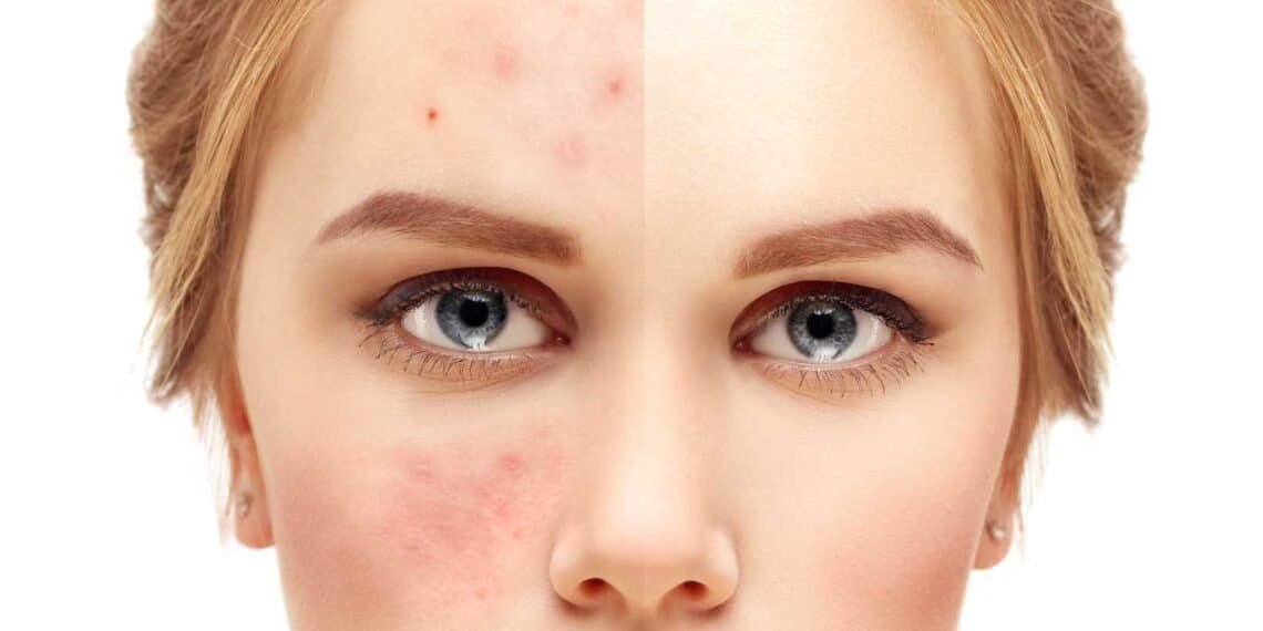 Could Mold be Causing or Aggravating Your Allergic Contact Dermatitis Symptoms?