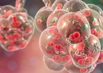 Could Mold be the Cause or Aggravator of Your Respiratory Infection Symptoms?