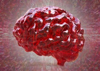 Cognitive Dysfunction: